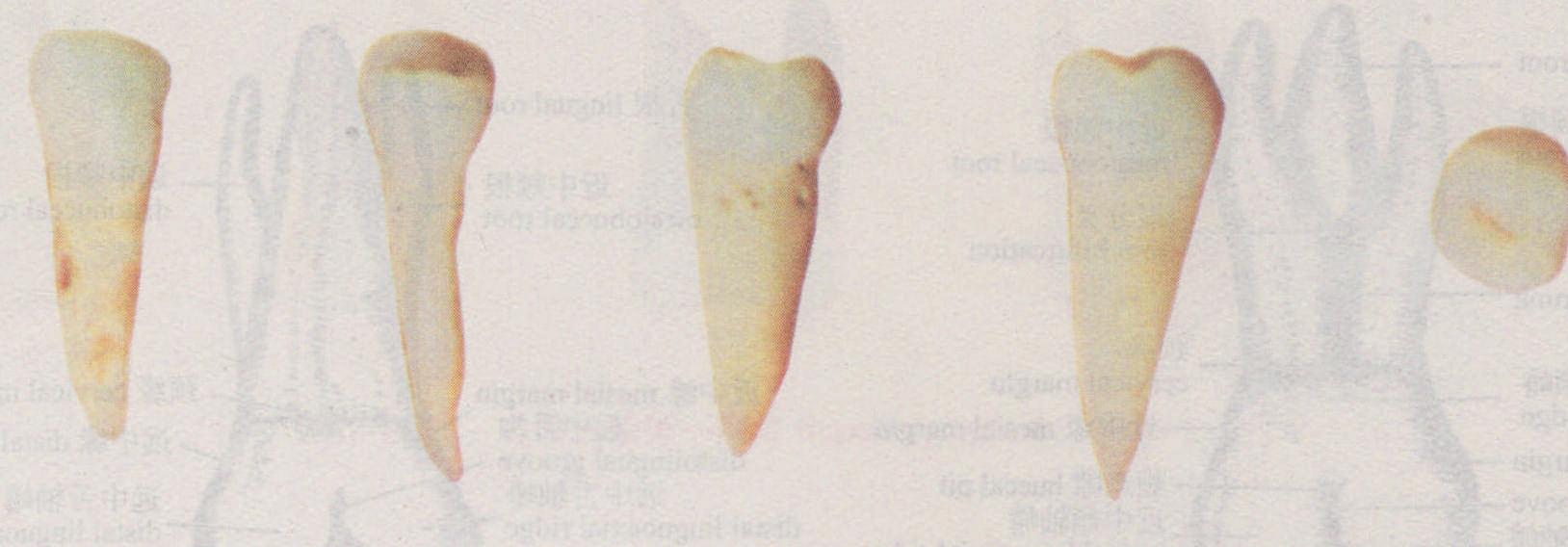 图1-2-22 右侧下颌第二前磨牙